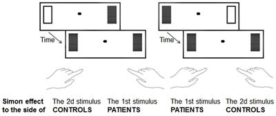 Is Schizophrenia a Disorder of Consciousness? Experimental and Phenomenological Support for Anomalous Unconscious Processing